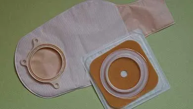 A two-piece ostomy system with a beige pouch and a separate square skin barrier wafer, displayed on a green surface.